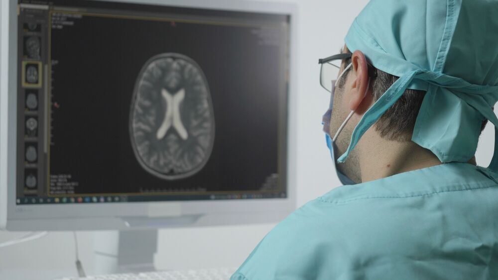 Photo of brain injury